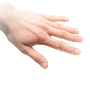 Abbildung von Hand mit transparenter Fingerschiene nach Stack 